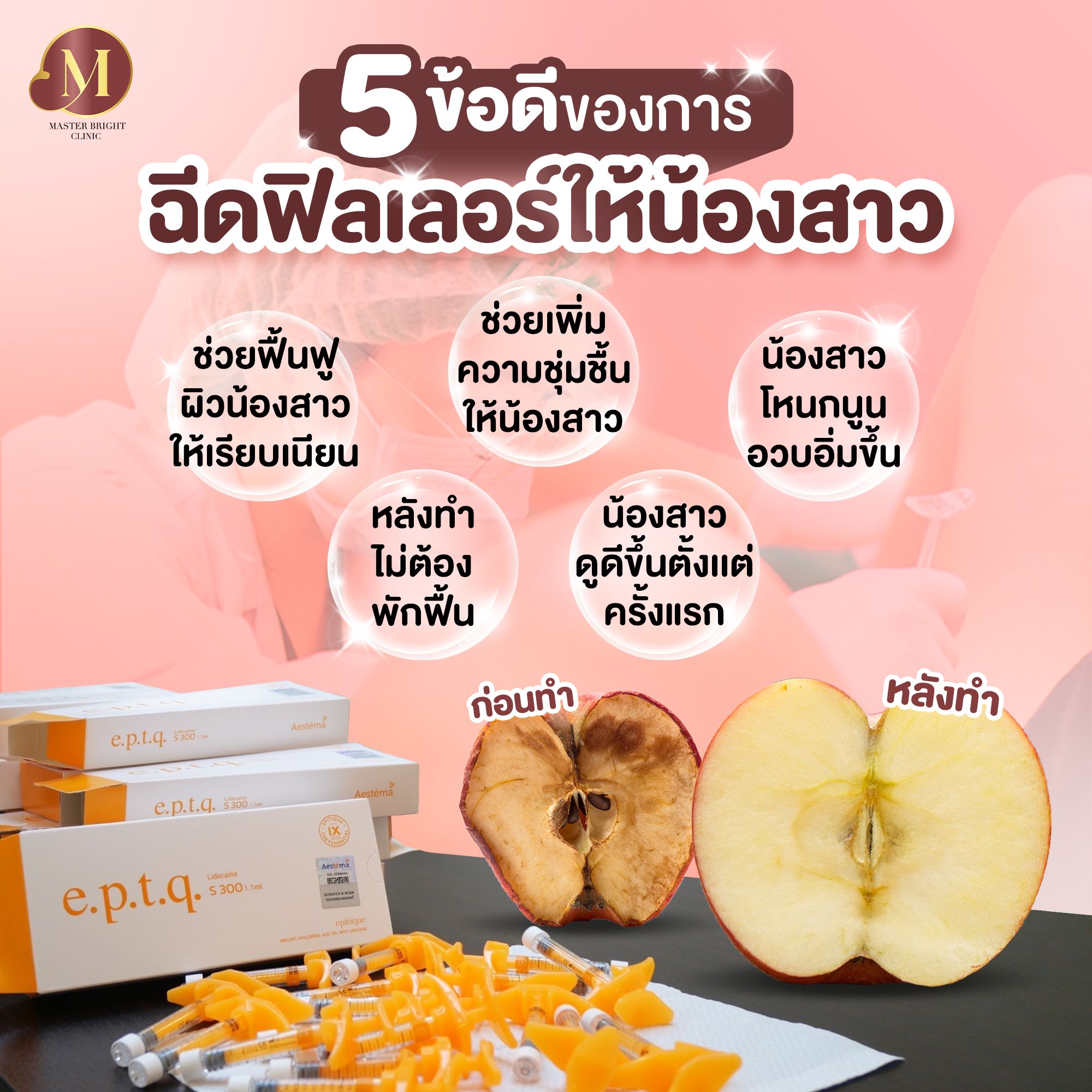 ฉีดฟิลเลอร์น้องสาวที่ Master Bright Clinic
