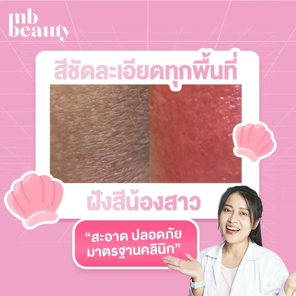 รีวิว ฝังสีน้อง