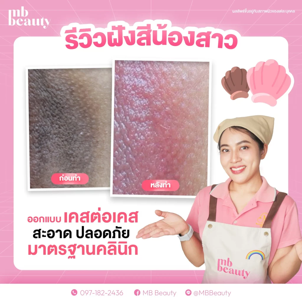 รีวิว ฝังสีน้อง