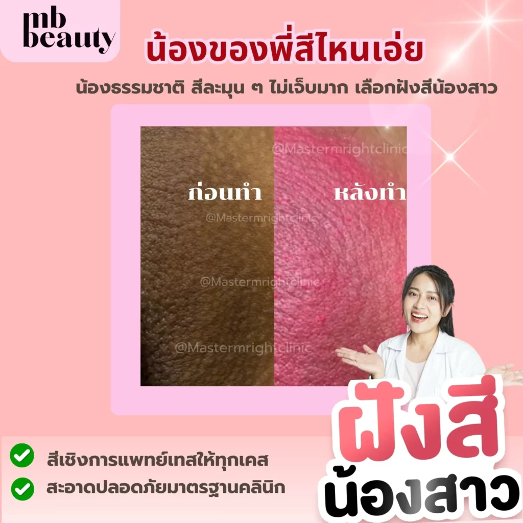 รีวิว ฝังสีน้อง