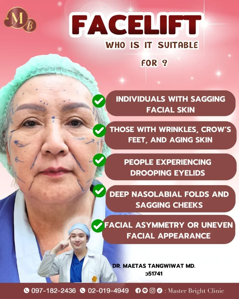 ใครที่ควรทำดึงหน้า แก้ไขปัญหาผิวหย่อนคล้อยและริ้วรอยแห่งวัย Master Bright Clinic